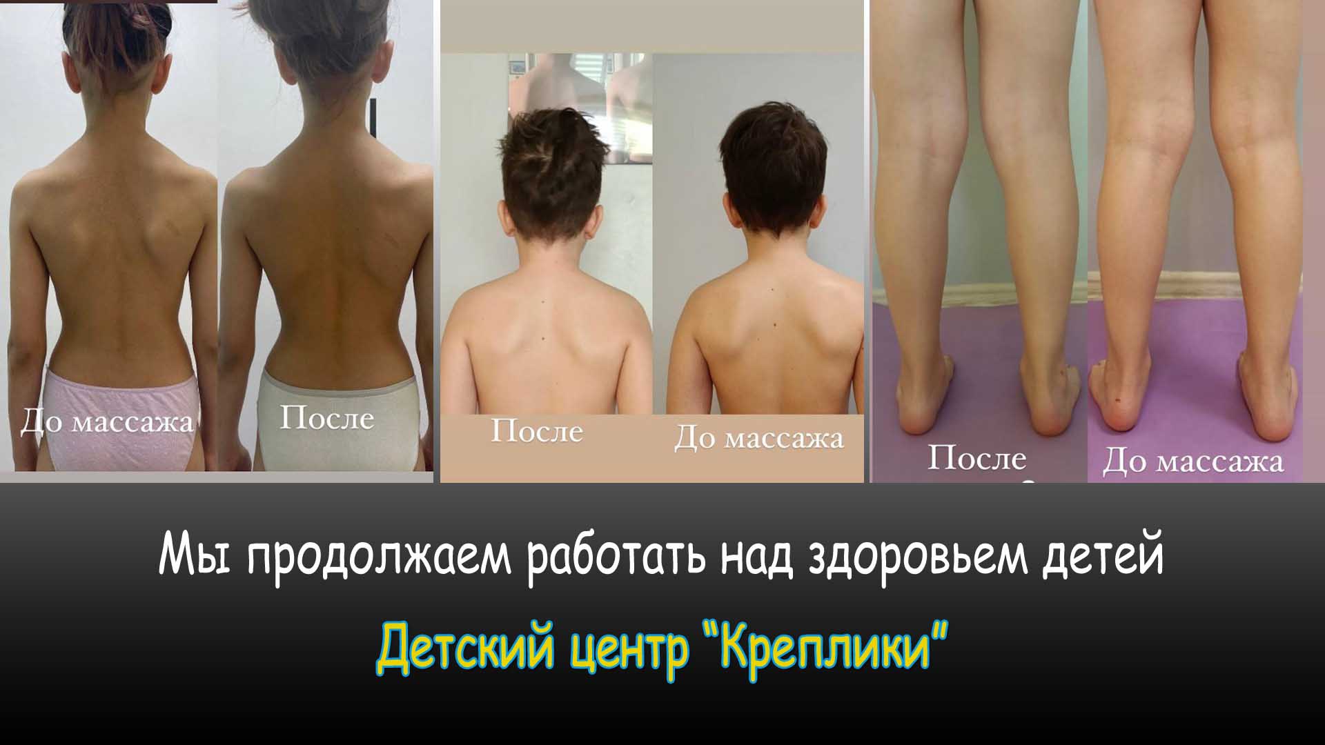 Укреплением здоровье детей