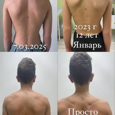 Детский массаж Мытищи