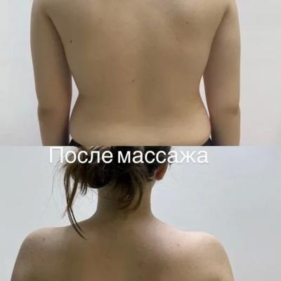 Детский массаж Мытищи