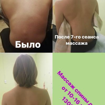 Массаж для детей в Мытищи