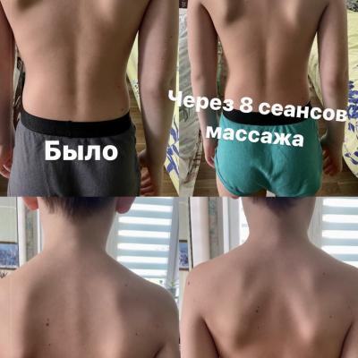 Массаж для детей в Мытищи