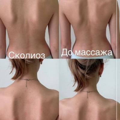 Детский массаж Мытищи