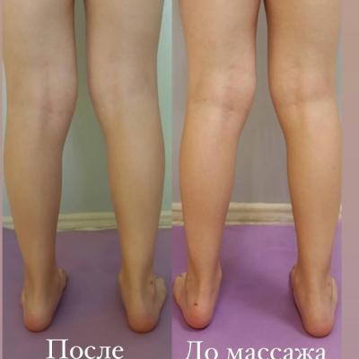 Массаж для детей в Мытищи