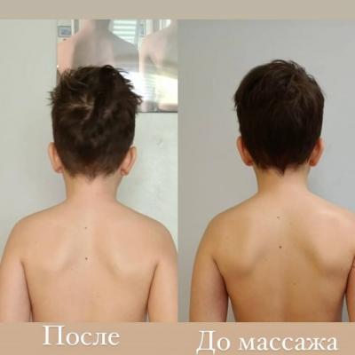 Массаж для детей в Мытищи