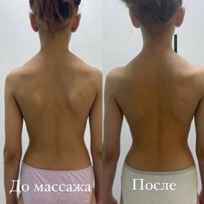 Массаж для детей в Мытищи