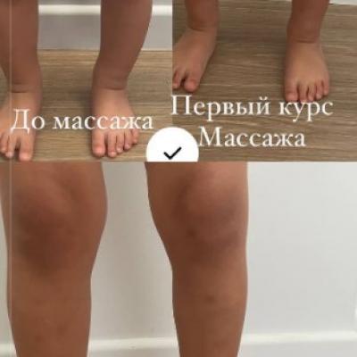 Массаж для детей в Мытищи